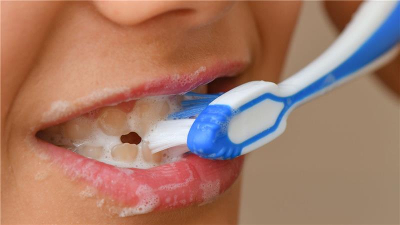 78 Prozent der Zwölfjährigen hätten keine Karies, heißt es in der Studie (Symbolbild).