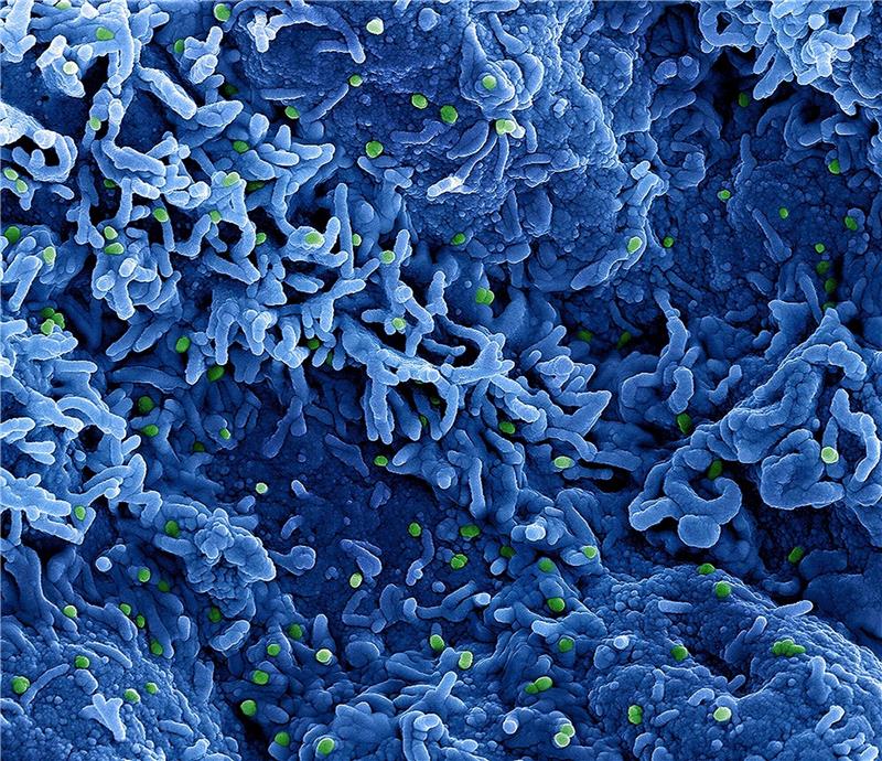 Affenpocken heißen nun Mpox statt Monkeypox. Auch das Virus selbst soll umbenannt werden.