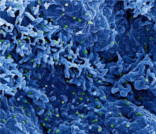 Affenpocken heißen nun Mpox statt Monkeypox. Auch das Virus selbst soll umbenannt werden.