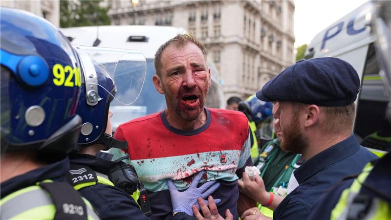 Rechte Großdemo in London: Zusammenstöße mit Polizei An mehreren Stellen kam es zu Zusammenstößen mit der Polizei.
