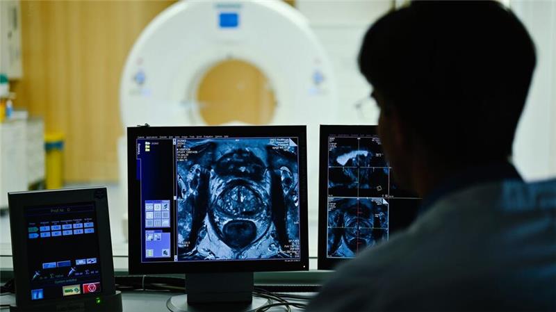 Krebsrisiko lässt sich um bis zu 40 Prozent senken Auf dem Monitor ist das Querschnittsbild einer Prostata zu sehen: Prostatakrebs gehört zu den häufigsten Krebsarten bei Männern. (Archivbild)