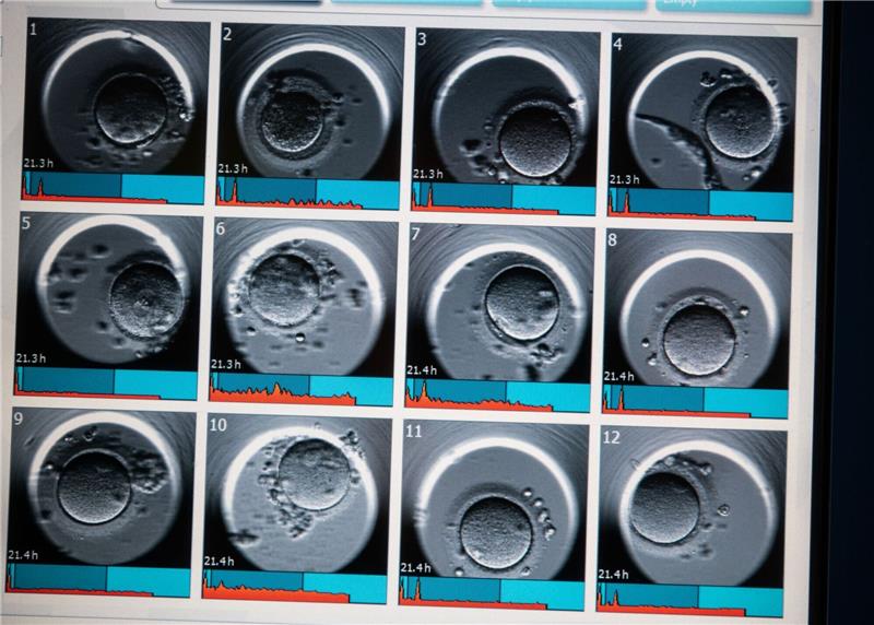 Frau mit krankem Mann darf Embryo-Gentest absetzen Auf dem Monitor sind Aufnahmen von Embryonen zu sehen.
