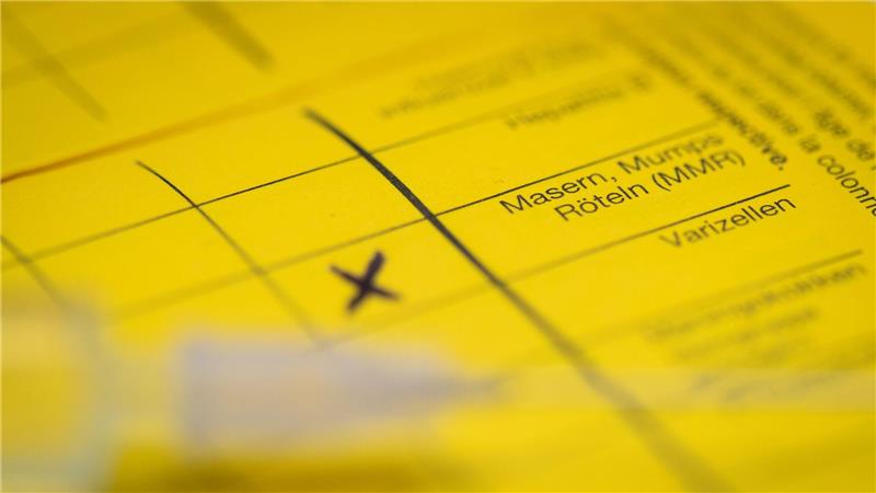 Bei Masern zeigt sich erst oft Fieber, bevor später ein Hautausschlag dazukommt. (Symbolbild)