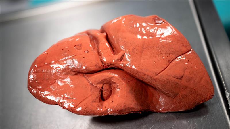 Medizin der Zukunft - ein Blick in einen besonderen OP Bei komplizierten Eingriffen üben die Mediziner mit Organen aus dem 3D-Druck.