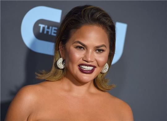 Chrissy Teigen über Buccal Fat Removal: «Ja, ich habe es getan, na und?»