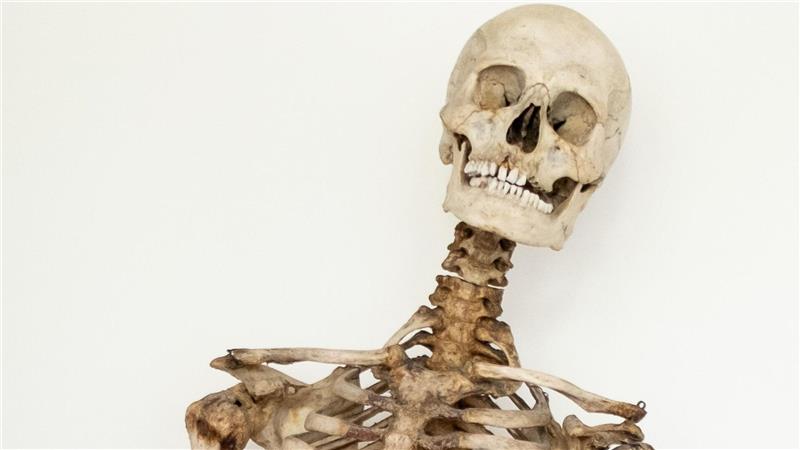 So flog die Skelett-Verwechslung beim Schinderhannes auf Dank wissenschaftlicher Analysen und eines Verwandten weiß man nun, dass dieses Skelett die sterblichen Überreste des Räubers Schinderhannes sind.