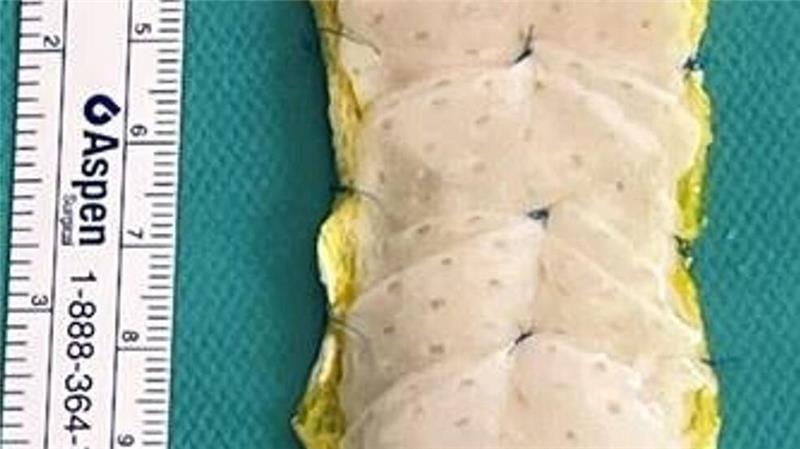 Stammzell-Herzpflaster soll schwere Herzschwäche kurieren Das „Herzpflaster“ wird aus Einzelteilen zusammengesetzt.
