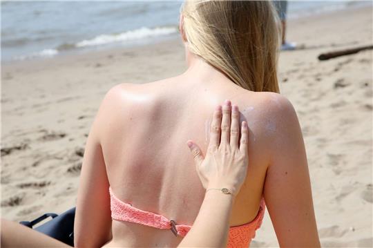 «Das Risiko, einen Sonnenbrand zu bekommen, ist abhängig vom Sonnenstand und in den Sommermonaten von Juni bis August sowie in der Mittagszeit zwischen 11 und 15 Uhr besonders hoch», sagte der Dermatologe Mark Berneburg der Deutschen Presse-Agentur.