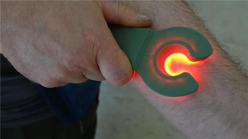 3D-Druckteile aus Deutschland helfen im Kampf der Ukraine Das Rotlicht eines Venensuchers hilft, die Venen zu erkennen.