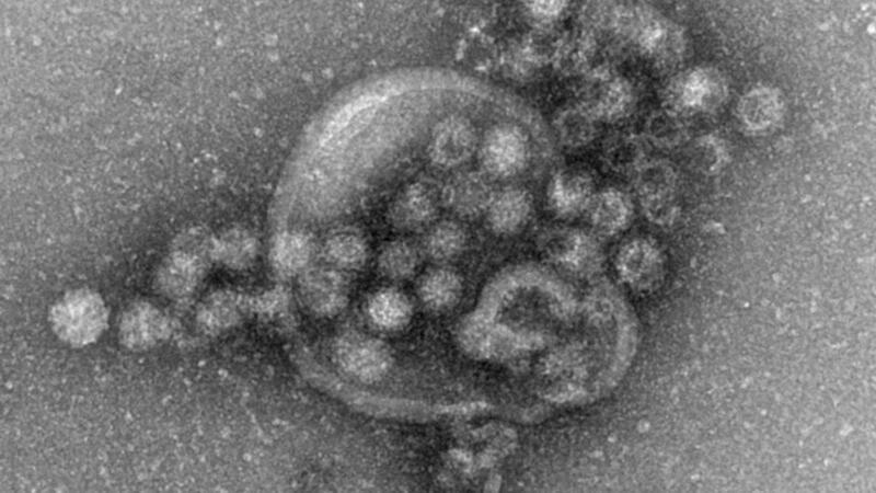 Entwarnung am Gardasee - Wasser wieder trinkbar Das hochansteckende Norovirus verursacht einen plötzlich auftretenden, heftigen Brechdurchfall. (Archivbild)