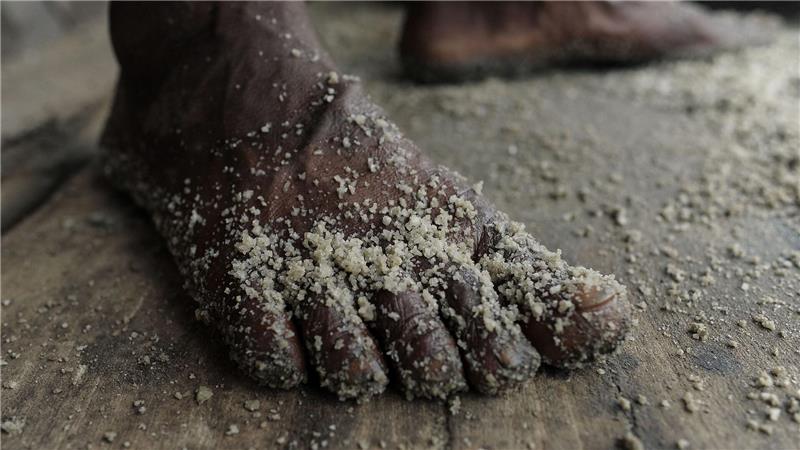 Der Fuß eines Arbeiters ist in einer Rohsalzraffinerie in Bangladesch mit Salz bedeckt.