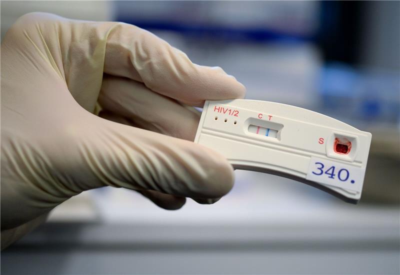 Der Teststreifen an einem HIV-Schnelltest verfärbt sich bei der Berliner Aids-Hilfe nach der Anwendung mit dem Blut eines Mannes.