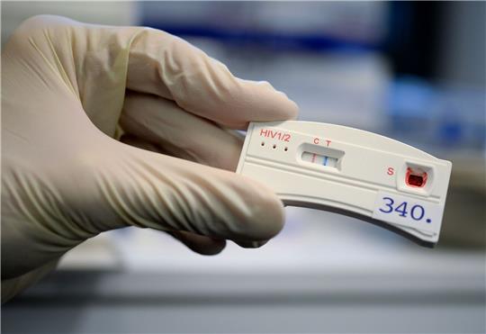 Der Teststreifen an einem HIV-Schnelltest verfärbt sich bei der Berliner Aids-Hilfe nach der Anwendung mit dem Blut eines Mannes.