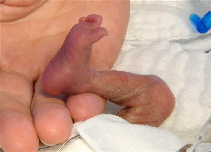 WHO: Frühchen brauchen Hautkontakt - noch vor dem Brutkasten Der direkte Hautkontakt von Frühchen und Mutter bzw. Betreuungsperson noch vor dem Brutkasten, kann einen positiven Einfluss auf die Entwicklung der Kinder haben.