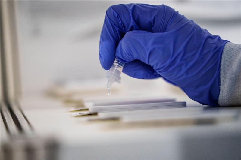 Quarantäne-Urteil für Rückkehrer aus Corona-Risikogebieten Die Abstrichlösung wird auf den Teststreifen gebracht.