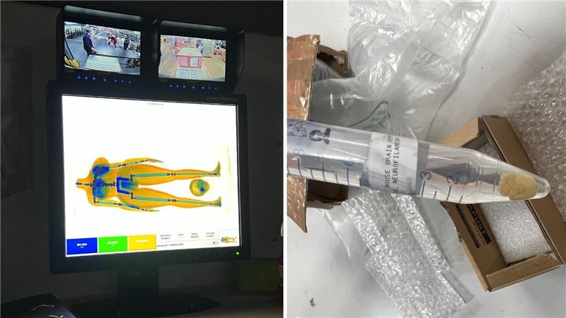 Kuriose Paketfunde: Mäusehirn, Pickelhaube und Sexpuppe Die Aufnahme der Sexpuppe im Röntgenmobil. Und das Gehirn einer Maus in einem Gefäß (re.). Foto: Hauptzollamt Braunschweig