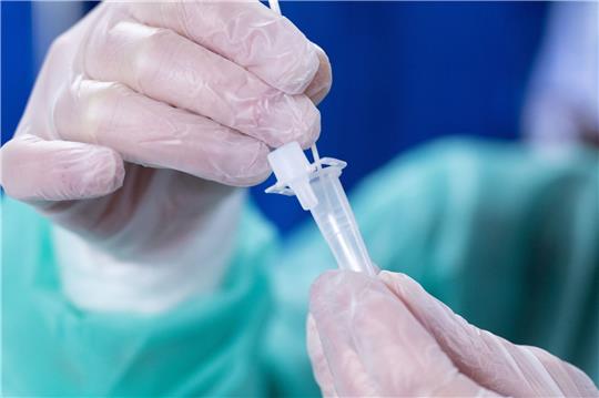 Die Omikron-Sublinie XBB.1.5 wird in den kommenden Monaten auch in Deutschland die dominante Variante werden.