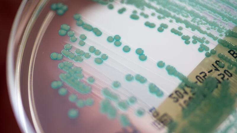 Datenanalyse: Antibiotika-Krise droht schlimmer zu werden Die Zahl der Todesfälle, bei denen multiresistente Keime eine Rolle spielen, könnte von 4,71 Millionen auf 8,22 Millionen steigen. (Archivbild)