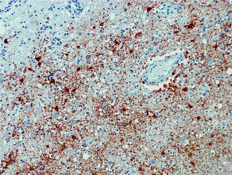 Die undatierte Aufnahme zeigt einen Anitkörpernachweis zum Borna-Virus im Gewebe.