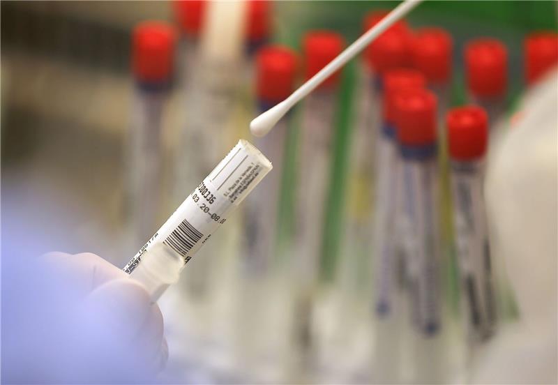 Weiter sinkende Corona-Zahlen in Niedersachsen Ein Abstrich wird in einem Labor auf das Coronavirus untersucht.