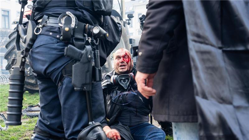 Feuer und Tränengas: Tausende Bauern bei Protest in Brüssel Ein Demonstrant sitzt verletzt auf einem Bordstein.