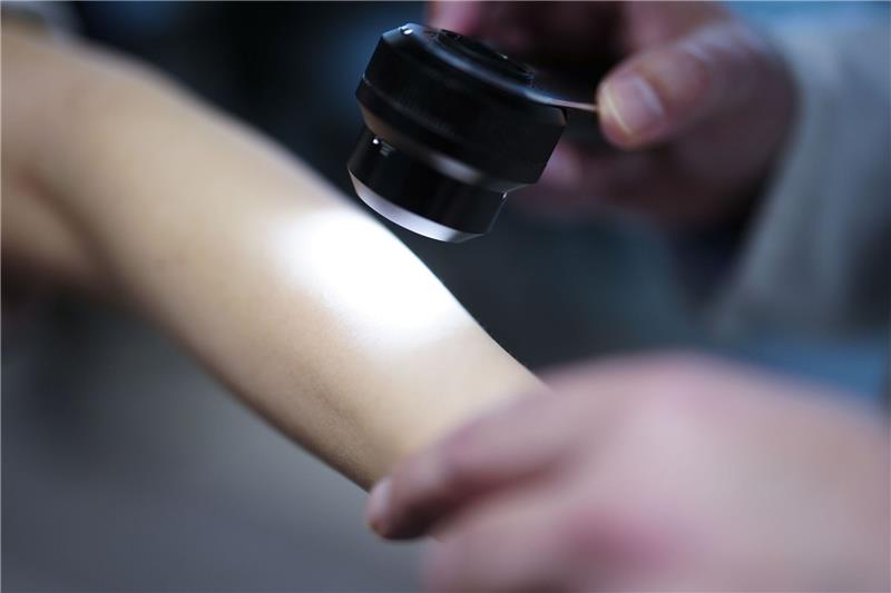 Verband fordert staatlich organisiertes Hautkrebs-Screening Ein Hautarzt untersucht bei einer Krebsvorsorgeuntersuchung eine Patientin mit einem Auflichtmikroskop.