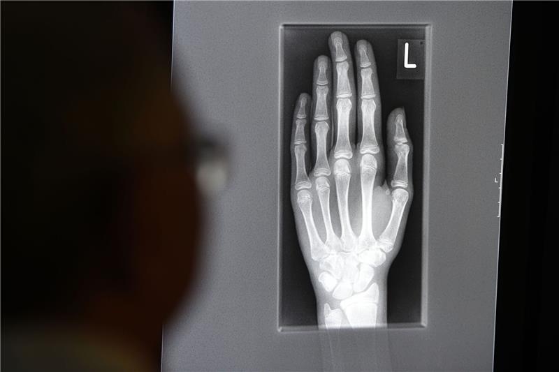 Medizinischer Revolutionär - Röntgen stirbt vor 100 Jahren Ein Röntgenbild auf einem Bildschirm zeigt in einem Klinikum in Baden-Württemberg die linke Hand eines jungen Menschen im Alter zwischen 16 und 19 Jahren.