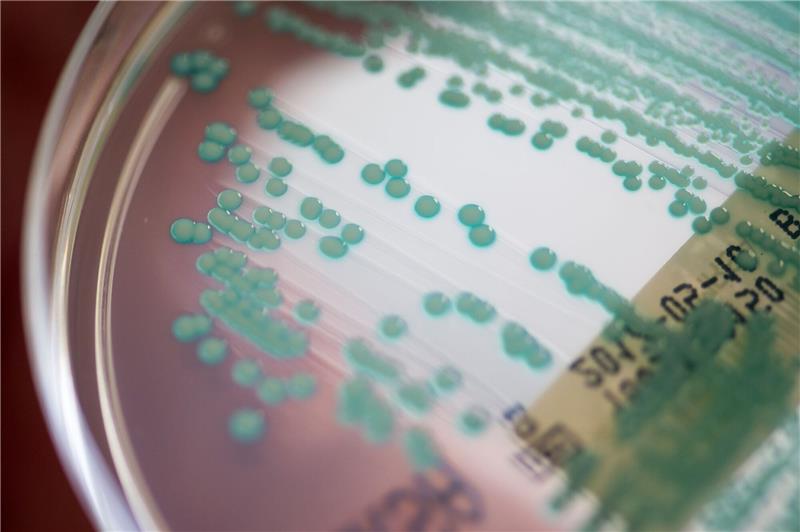 Pandemie ohne Ende: 35.000 Tote durch Antibiotikaresistenzen Eine Petrischale mit MRSA-Keimen, aufgenommen im Universitätsklinikum Regensburg.