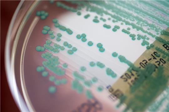 Eine Petrischale mit MRSA-Keimen, aufgenommen im Universitätsklinikum Regensburg.