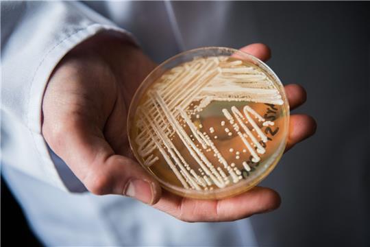Eine Petrischale mit dem Hefepilz Candida auris. In Deutschland werden immer mehr Fälle des krankmachenden Pilzes bekannt.