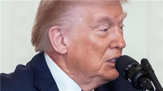 Eine Stelle an Trumps Hals hat eine Welle von Spekulationen über die Gesundheit des Präsidenten ausgelöst.