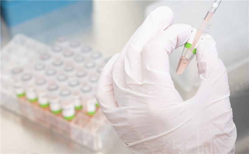Corona: FDP für stärkere Ermittlung des Antikörperspiegels Eine biologisch-technische Assistentin bereitet PCR-Tests für die Analyse vor.