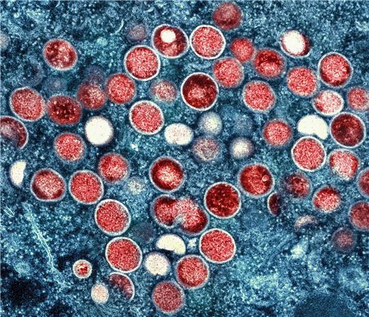 Eine eingefärbte Mikroskopaufnahme von Mpox-Partikeln (rot) in einer infizierten Zelle (blau), die im Labor kultiviert wurde.