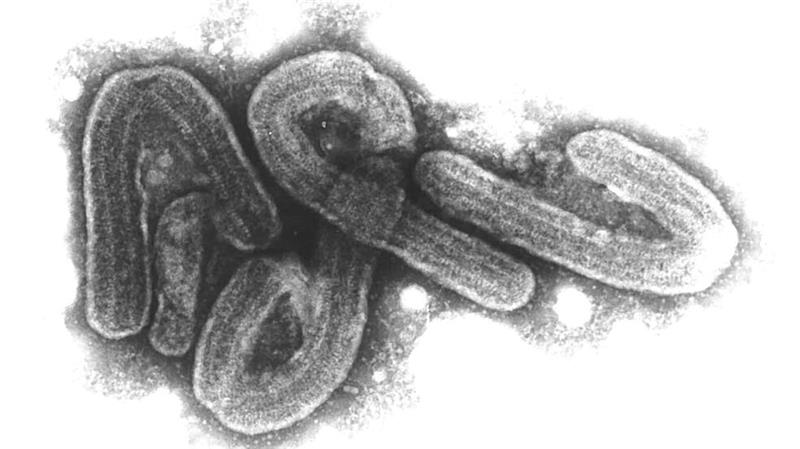 Eine elektronenmikroskopische Aufnahme des Marburg-Virus.