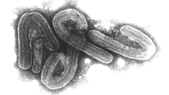 Eine elektronenmikroskopische Aufnahme des Marburg-Virus. (Archivbild)