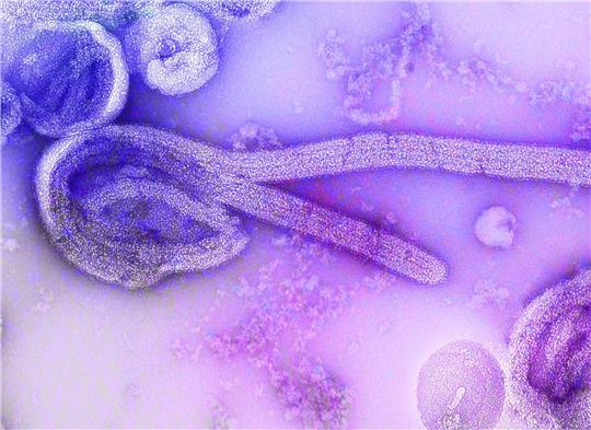 Eine elektronenmikroskopische Aufnahme des Marburgvirus. Im zentralafrikanischen Äquatorialguinea ist der Ausbruch des lebensgefährlichen Marburg-Fiebers bestätigt worden. (Bild von 1968)