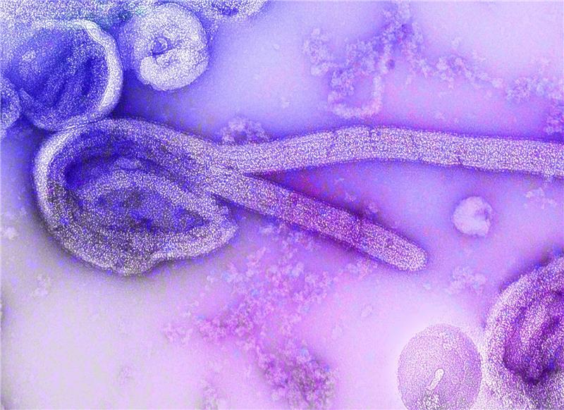 WHO erklärt Marburg-Ausbruch in Äquatorialguinea für beendet Eine elektronenmikroskopische Aufnahme eines Marburg-Virus.