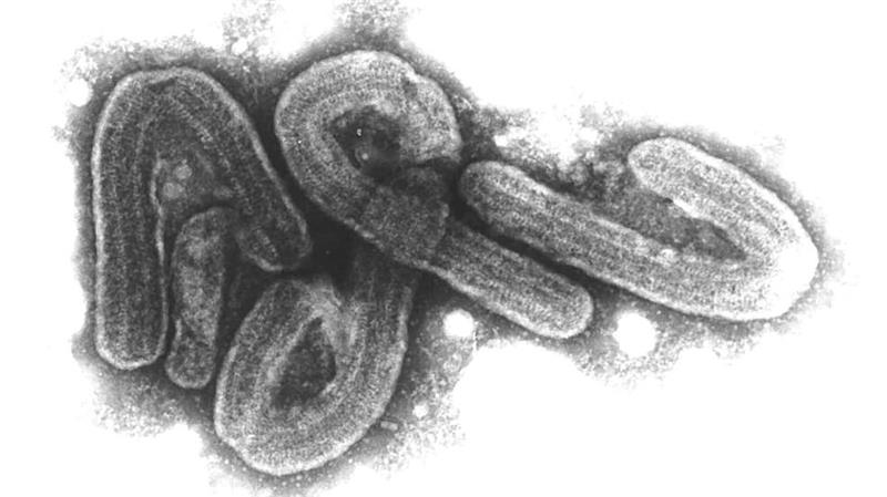 Ruanda findet Ursprung des Marburg-Ausbruchs Elektronenmikroskopische Aufnahme des Marburg-Virus. Das Marburg-Virus gehört zu den gefährlichsten bekannten Krankheitserregern.