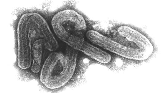 Elektronenmikroskopische Aufnahme des Marburg-Virus. Das Marburg-Virus gehört zu den gefährlichsten bekannten Krankheitserregern.