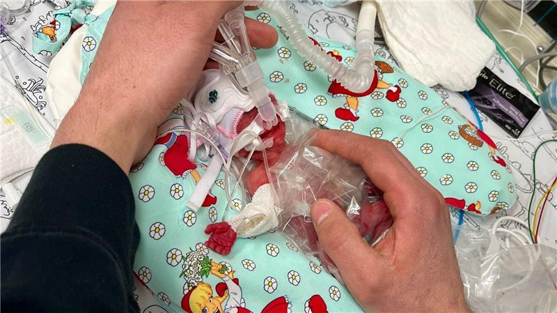 Etwas mehr als ein Päckchen Butter wog die kleine Marie, als sie im Februar zur Welt kam. Seitdem ist das Kind gut gewachsen.