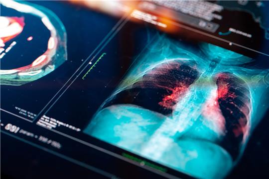 Früherkennung per moderner Bildgebung: Mithilfe einer Computertomographie sollen bösartige Gewebebildungen künftig entdeckt werden. Foto: da-kuk/Getty