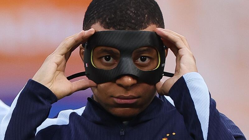 Frankreich auf der verzweifelten Suche nach Torschützen Hatte sich in der Partie gegen Österreich einen Nasenbeinbruch zugezogen: Frankreichs Kylian Mbappe.