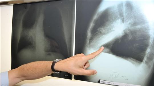 Im Winter weniger zu lüften, kann die Belastung mit krebserregendem Radon in der Wohnung erhöhen. (Archivbild)