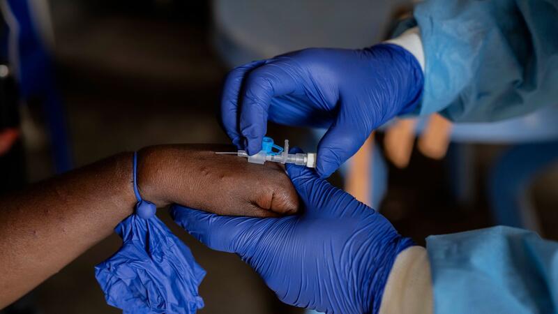 Wie sich Fake News über Mpox verbreiten In afrikanischen Ländern wie hier in der Demokratischen Republik Kongo sind Impfungen gegen die Affenpocken lebensnotwendig. (Archivbild)