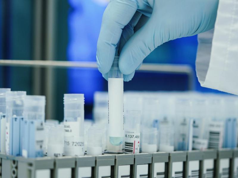 Wer jetzt noch einen PCR-Test bekommt In den Laboren werden zurzeit so viele PCR-Tests gemacht wie noch nie. Foto: Uwe Anspach/dpa