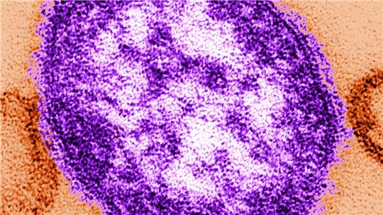 In den USA wurden seit Anfang des Jahres fast 1000 Masern-Fälle gemeldet.