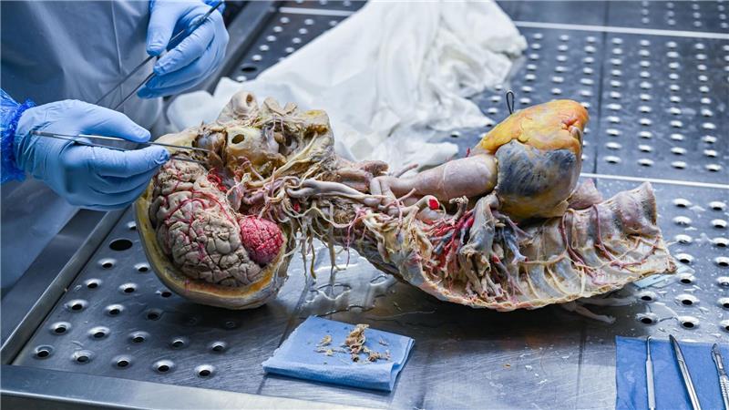 In der Werkstatt im brandenburgischen Guben entstehen die Plastinate der Organe. (Archivbild)