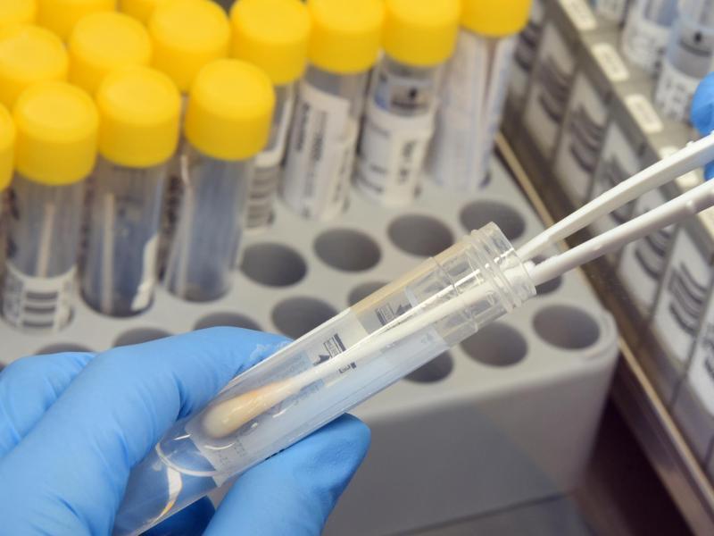 Stress im PCR-Labor: „Schauen Sie, alle Tests positiv, bis auf einen!“ In einem Labor werden PCR-Tests analysiert. Foto: Waltraud Grubitzsch/dpa