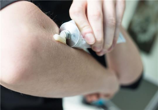 In einer Studie wurden der Einfluss von geringen Cortison-Mengen auf den Blutdruck und das Gewicht von Rheuma-Patienten untersucht.