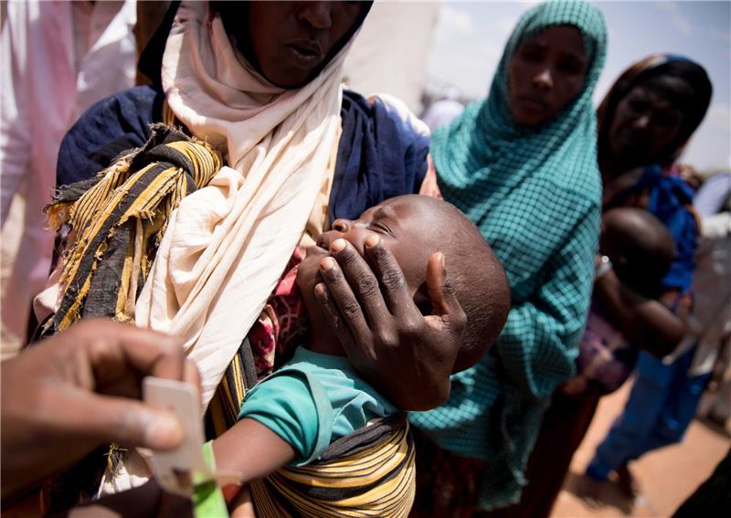 UN: 165 Millionen Menschen zusätzlich unter Armutsgrenze In einer medizinischen Einrichtung in der von Hunger geplagten Region Somali in Äthiopien wird der Armumfang eines Babys gemessen.